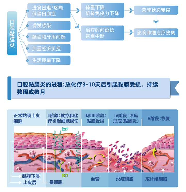 益普舒 -口腔凝胶快速缓解口腔疼痛,疗效长达8小时_在线订购